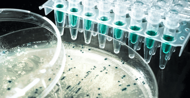 Petri dishes and test tubes illustrating the importance of bacterial filters in experiments.