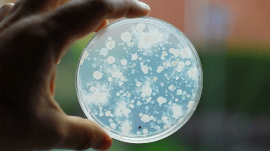 Hand holding a microbial count plate.